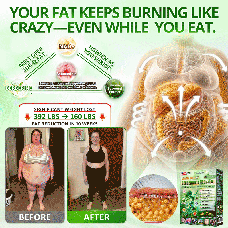 UpSell𝑶𝒇𝒇𝒊𝒄𝒊𝒂𝒍 𝑺𝒕𝒐𝒓𝒆 | 𝐍𝐞𝐰!🍀𝐂𝐚𝐫𝐞𝐔𝐩𝐥𝐢𝐟𝐭® 𝐁𝐫𝐨𝐰𝐧 𝐒𝐞𝐚𝐰𝐞𝐞𝐝× 𝐁𝐞𝐫𝐛𝐞𝐫𝐢𝐧𝐞× 𝐍𝐃𝐀+ 𝟏𝟎-𝐢𝐧-𝟏 𝐍𝐚𝐧𝐨 𝐌𝐢𝐜𝐫𝐨𝐧𝐞𝐞𝐝𝐥𝐞 𝐏𝐚𝐭𝐜𝐡(𝐉𝐮𝐬𝐭 𝐨𝐧𝐜𝐞 𝐚 𝐝𝐚𝐲, 𝐯𝐢𝐬𝐢𝐛𝐥𝐞 𝐜𝐡𝐚𝐧𝐠𝐞𝐬 𝐢𝐧 𝟕 𝐝𝐚𝐲𝐬）𝘽𝙚𝙧𝙗𝙚𝙧𝙞𝙣𝙚 + 𝐁𝐫𝐨𝐰𝐧 𝐒𝐞𝐚𝐰𝐞𝐞𝐝 𝙁𝙤𝙧𝙢𝙪𝙡𝙖 ✅ 𝐅𝐨𝐫 𝐨𝐛𝐞𝐬𝐢𝐭𝐲, 𝗟𝗼𝗼𝘀𝗲 𝘀𝗸𝗶𝗻,𝐝𝐢𝐚𝐛𝐞𝐭𝐞𝐬, 𝐬𝐥𝐞𝐞𝐩 𝐚𝐩𝐧𝐞𝐚, 𝐣𝐨𝐢𝐧𝐭 𝐢𝐬𝐬𝐮𝐞𝐬, 𝐚𝐧𝐝 𝐦𝐨𝐫𝐞💯💯