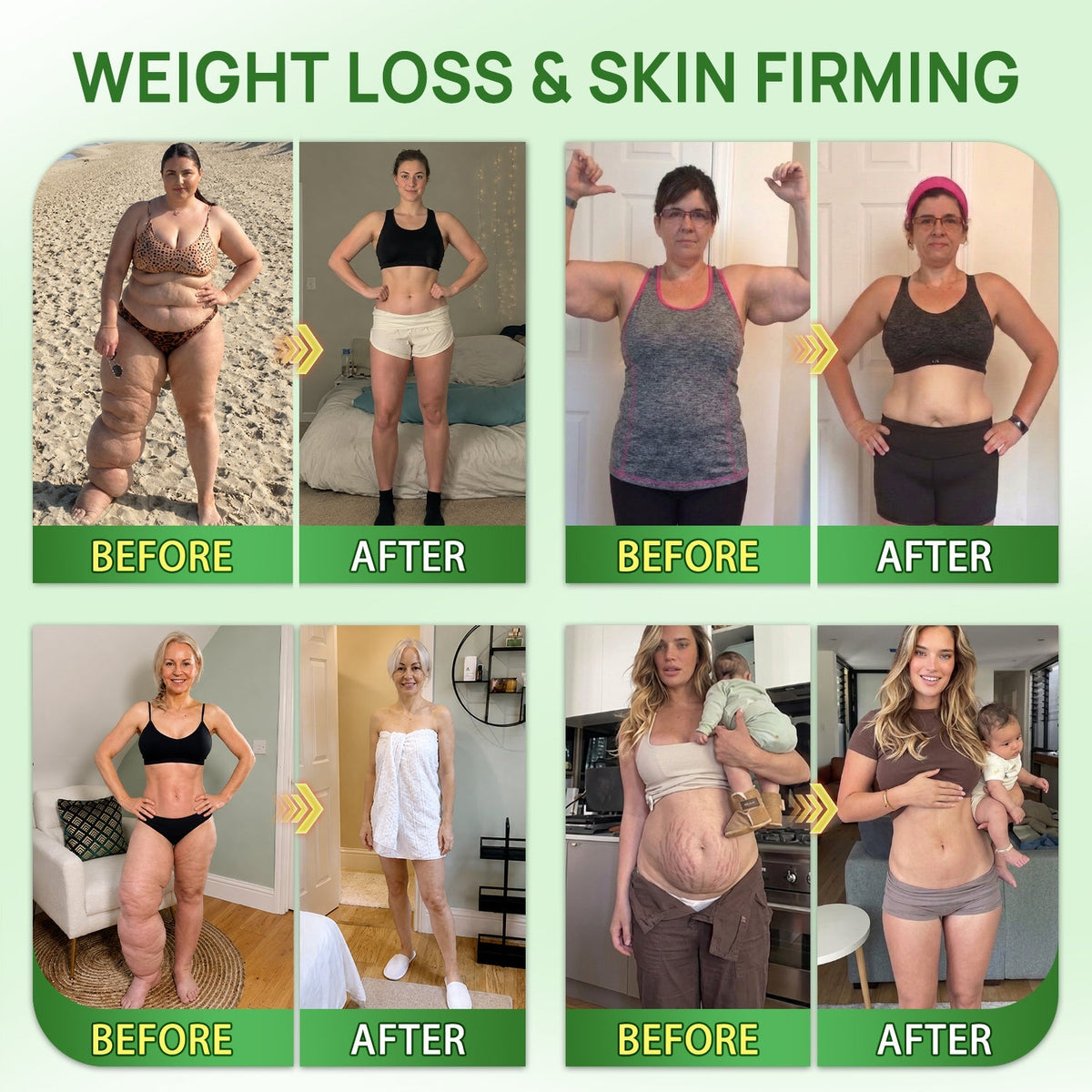 UpSell𝑶𝒇𝒇𝒊𝒄𝒊𝒂𝒍 𝑺𝒕𝒐𝒓𝒆 | 𝐍𝐞𝐰!🍀𝐂𝐚𝐫𝐞𝐔𝐩𝐥𝐢𝐟𝐭® 𝐁𝐫𝐨𝐰𝐧 𝐒𝐞𝐚𝐰𝐞𝐞𝐝× 𝐁𝐞𝐫𝐛𝐞𝐫𝐢𝐧𝐞× 𝐍𝐃𝐀+ 𝟏𝟎-𝐢𝐧-𝟏 𝐍𝐚𝐧𝐨 𝐌𝐢𝐜𝐫𝐨𝐧𝐞𝐞𝐝𝐥𝐞 𝐏𝐚𝐭𝐜𝐡(𝐉𝐮𝐬𝐭 𝐨𝐧𝐜𝐞 𝐚 𝐝𝐚𝐲, 𝐯𝐢𝐬𝐢𝐛𝐥𝐞 𝐜𝐡𝐚𝐧𝐠𝐞𝐬 𝐢𝐧 𝟕 𝐝𝐚𝐲𝐬）𝘽𝙚𝙧𝙗𝙚𝙧𝙞𝙣𝙚 + 𝐁𝐫𝐨𝐰𝐧 𝐒𝐞𝐚𝐰𝐞𝐞𝐝 𝙁𝙤𝙧𝙢𝙪𝙡𝙖 ✅ 𝐅𝐨𝐫 𝐨𝐛𝐞𝐬𝐢𝐭𝐲, 𝗟𝗼𝗼𝘀𝗲 𝘀𝗸𝗶𝗻,𝐝𝐢𝐚𝐛𝐞𝐭𝐞𝐬, 𝐬𝐥𝐞𝐞𝐩 𝐚𝐩𝐧𝐞𝐚, 𝐣𝐨𝐢𝐧𝐭 𝐢𝐬𝐬𝐮𝐞𝐬, 𝐚𝐧𝐝 𝐦𝐨𝐫𝐞💯💯
